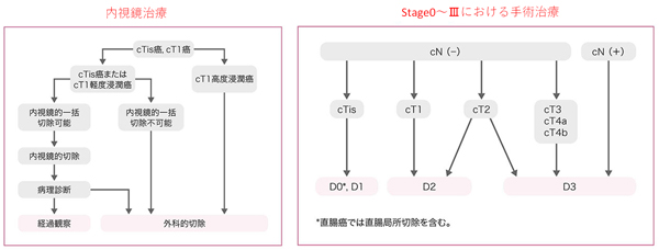 大腸癌の治療方針