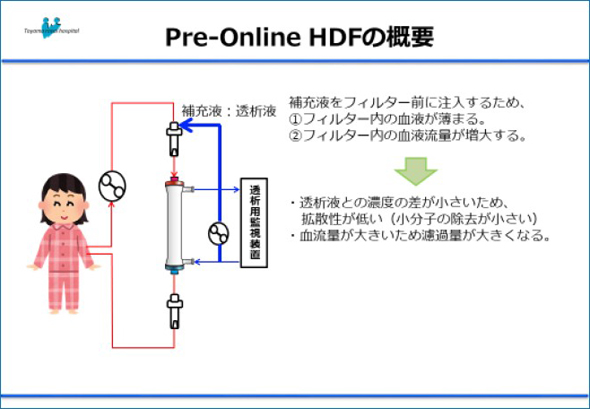 透析システム構成