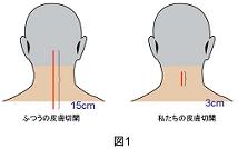 手術法