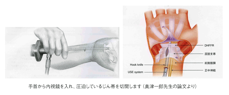 末梢神経の病気